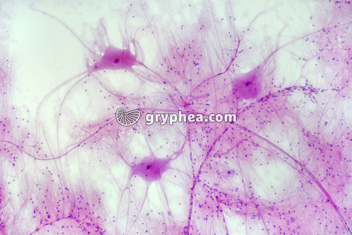 Neurones multipolaires de la Moelle épinière  x40 - gryphea.com